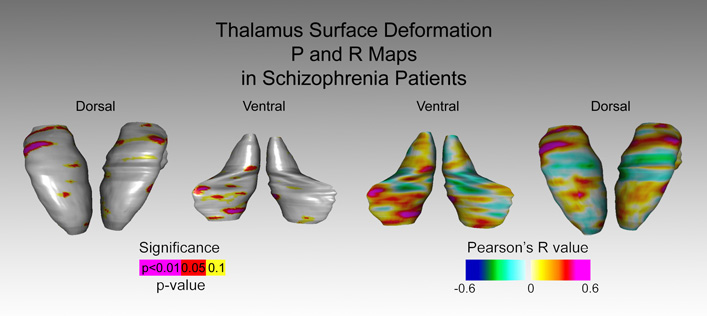 pmaps and rmaps of the thalamus