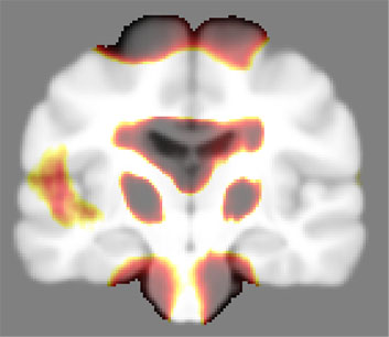 Dicom to analyze.img