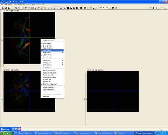 Left hemisphere of colormap, without green outline