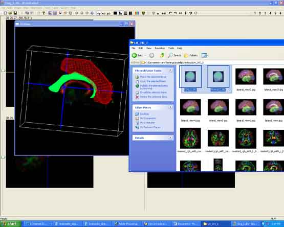 Objects applied to hemisphere