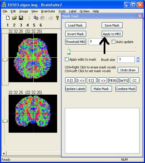 Apply mask to MRI