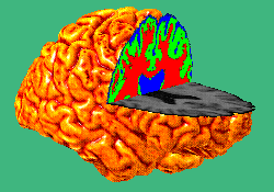 Cortex with multicolored cutouts