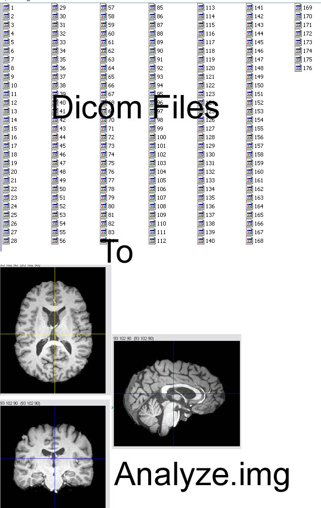 Dicom to analyze.img