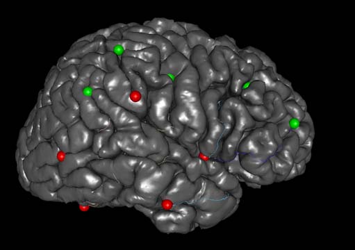 Dicom to analyze.img