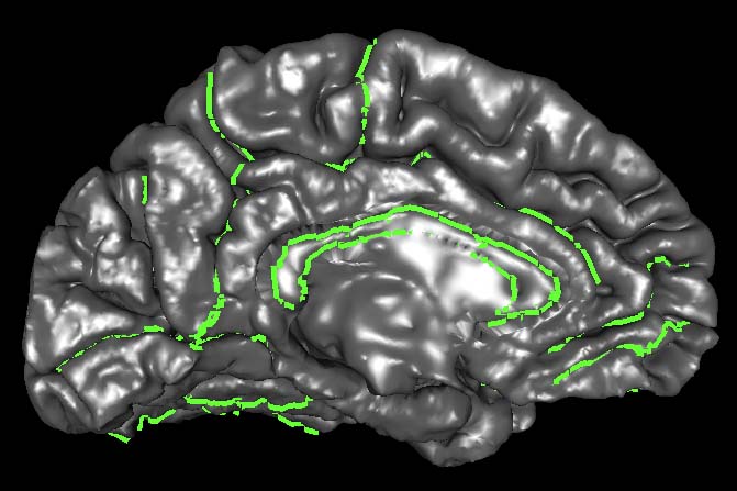 Dicom to analyze.img