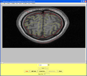 Be sure to label the meninges as non-brain