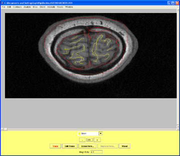 Label meninges as non-brain