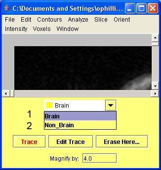 Setting brain and non-brain contours