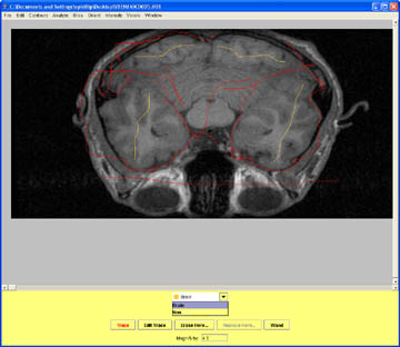 Masking out the cerebellum